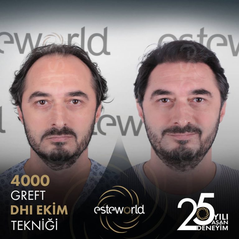 berkay-davut-özışık