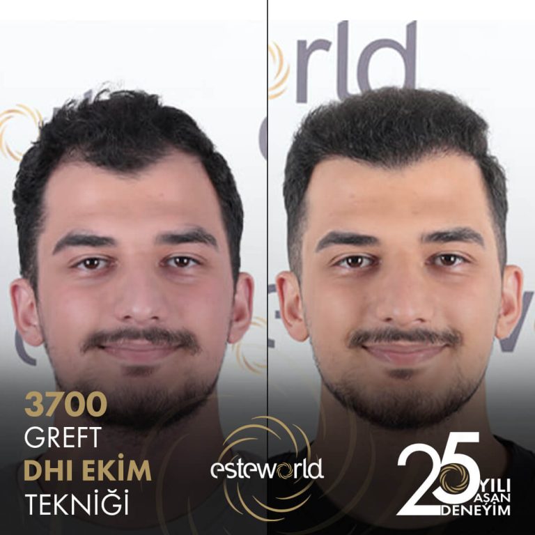 ömer-faruk-sevindik