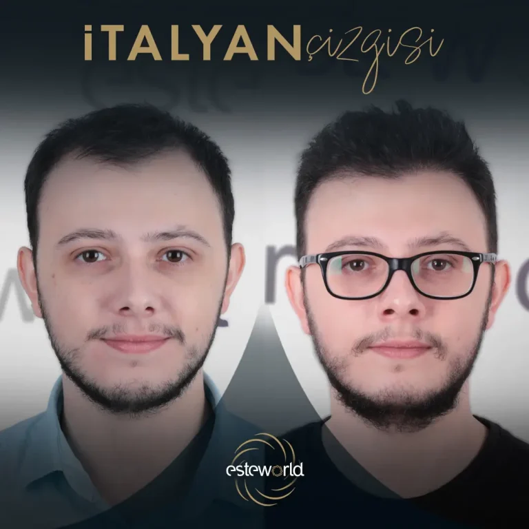 İtalyan Çizgisi - BA - 1