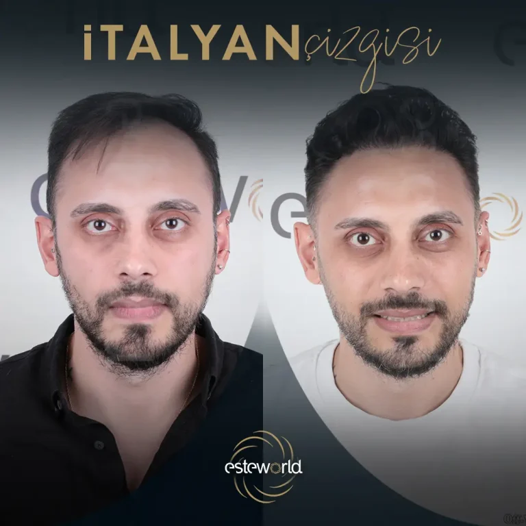 İtalyan Çizgisi - BA - 10