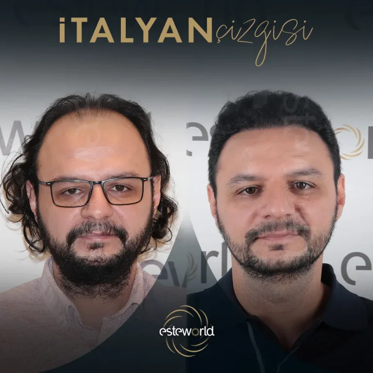 İtalyan Çizgisi - BA - 12