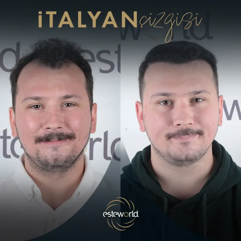 İtalyan Çizgisi - BA - 13