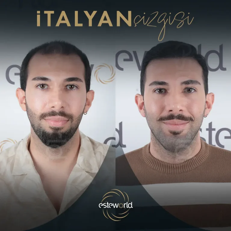 İtalyan Çizgisi - BA - 14 (1)