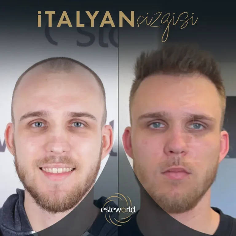 İtalyan Çizgisi - BA - 16