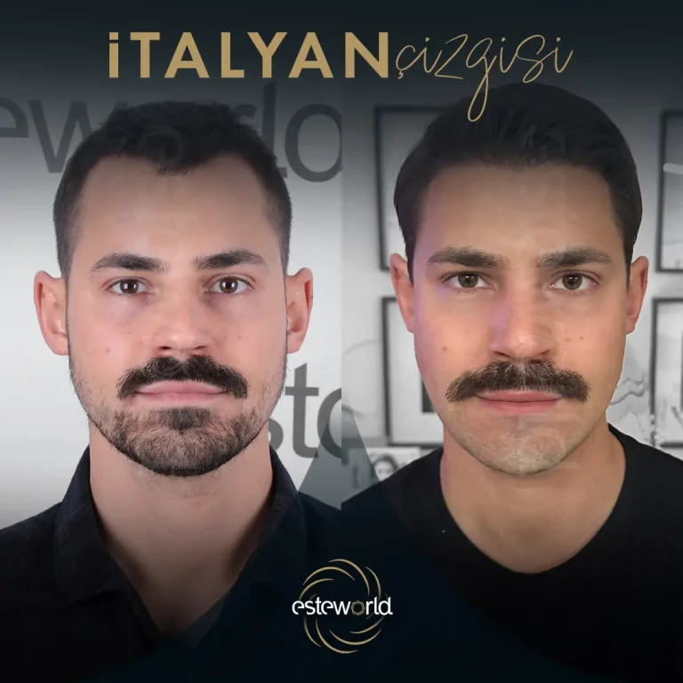 İtalyan Çizgisi - BA - 2