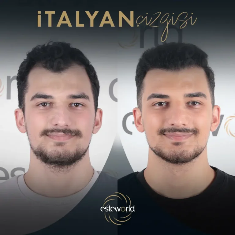 İtalyan Çizgisi - BA - 3