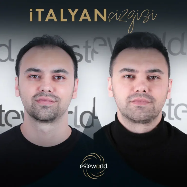 İtalyan Çizgisi - BA - 4