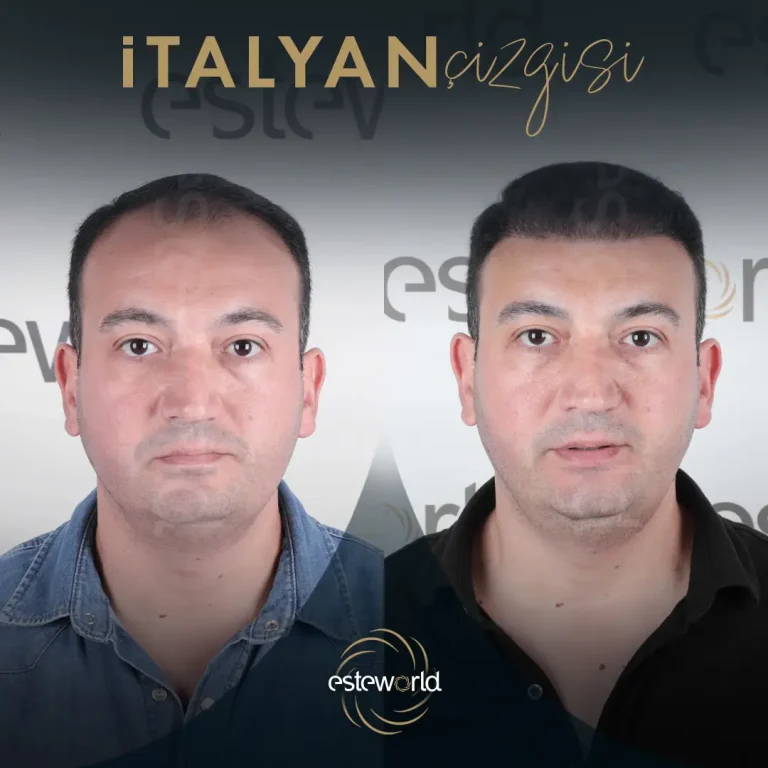 İtalyan Çizgisi - BA - 5