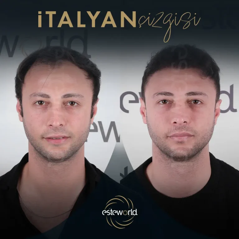 İtalyan Çizgisi - BA - 6