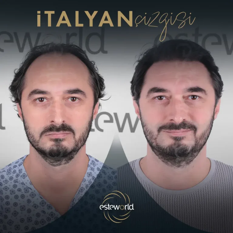 İtalyan Çizgisi - BA - 7