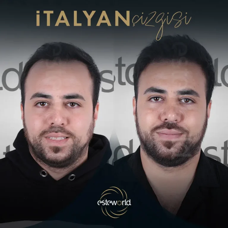 İtalyan Çizgisi - BA - 9