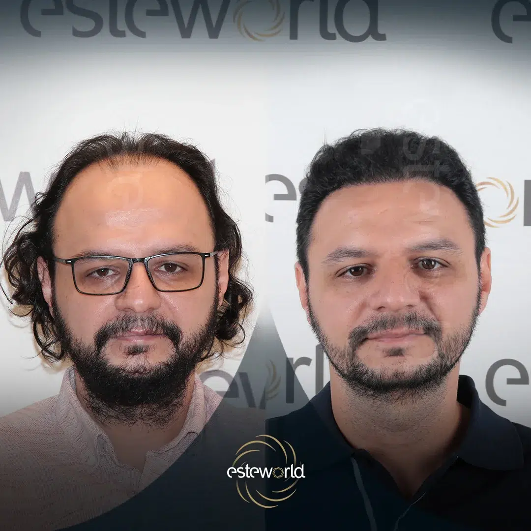 hair-before-after0-1