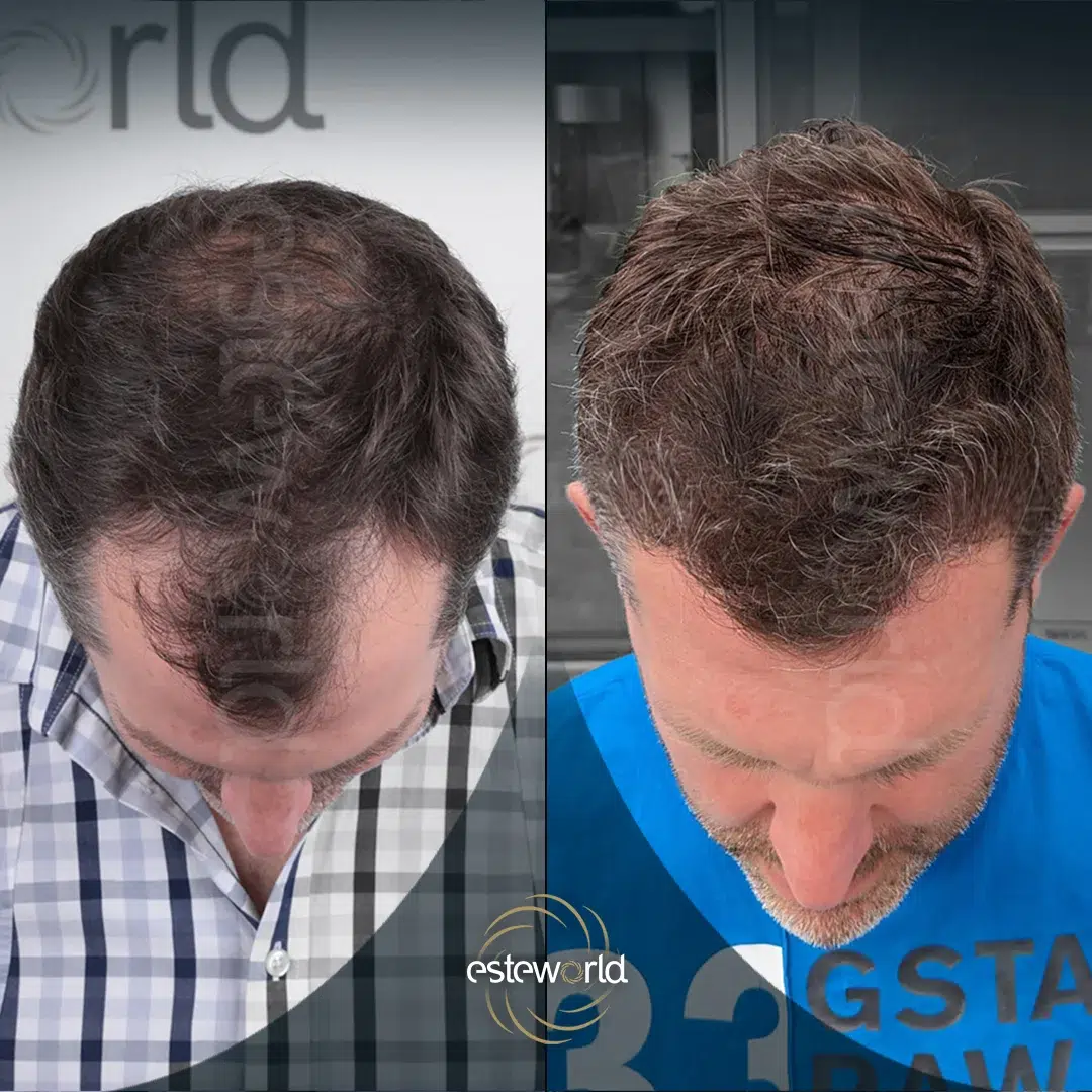 hair-before-after20-1