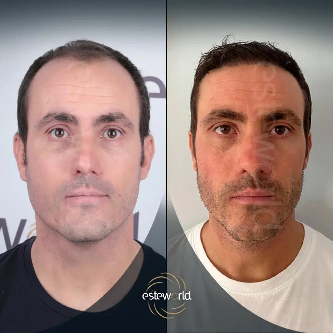 hair-before-after22-1