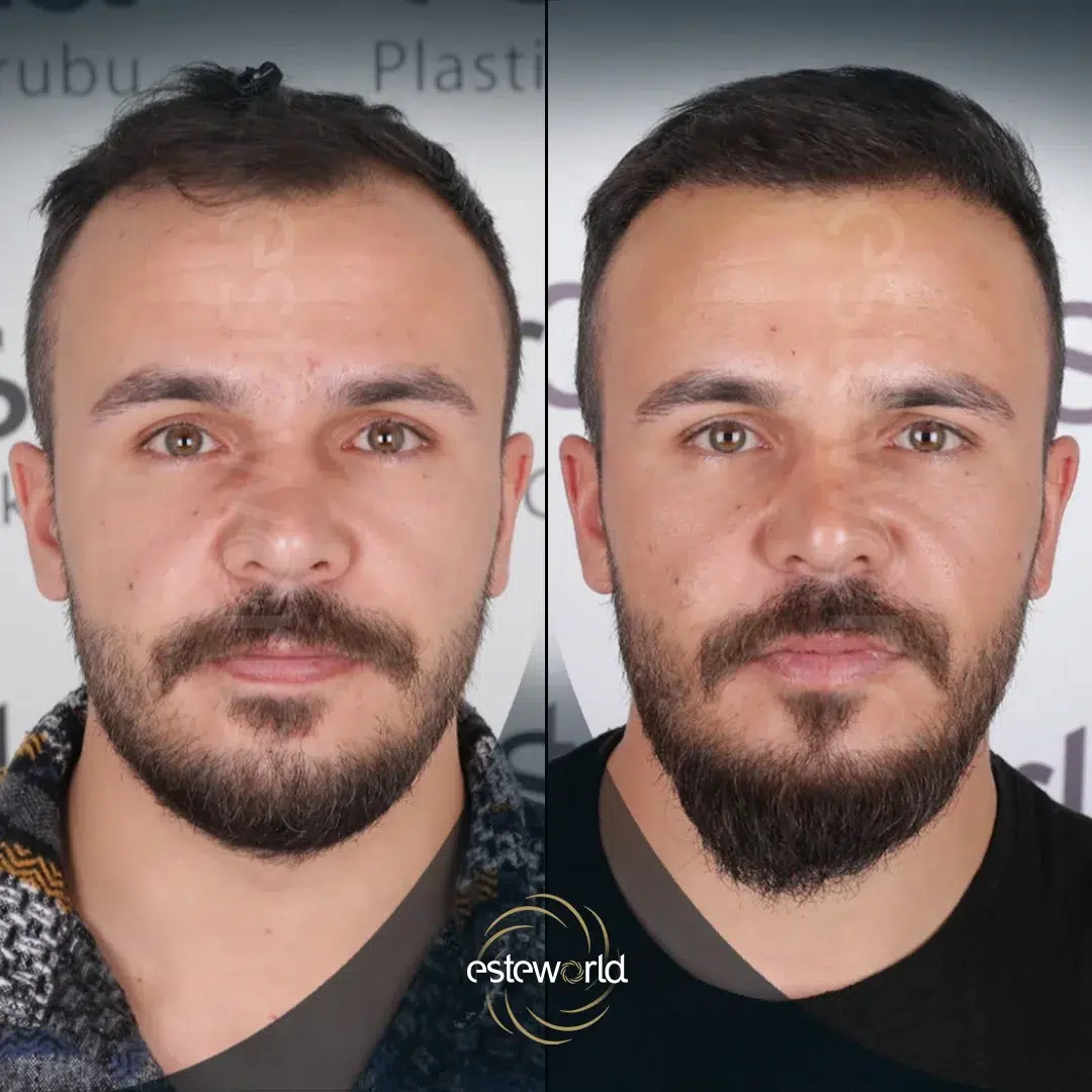 hair-before-after25-1