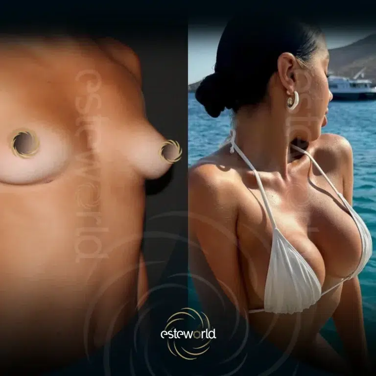 venus-before-after1